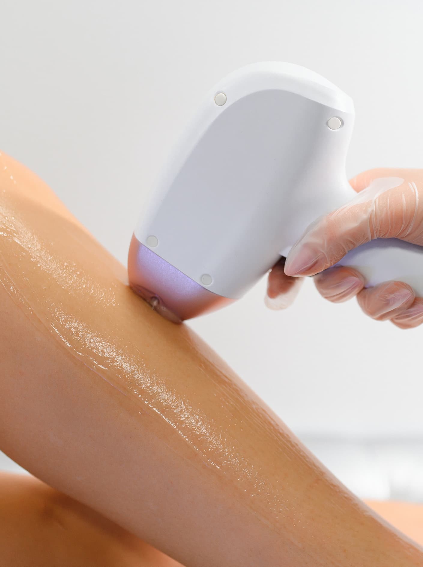 Diode laser hair removal session at Clear Skin Radstock
